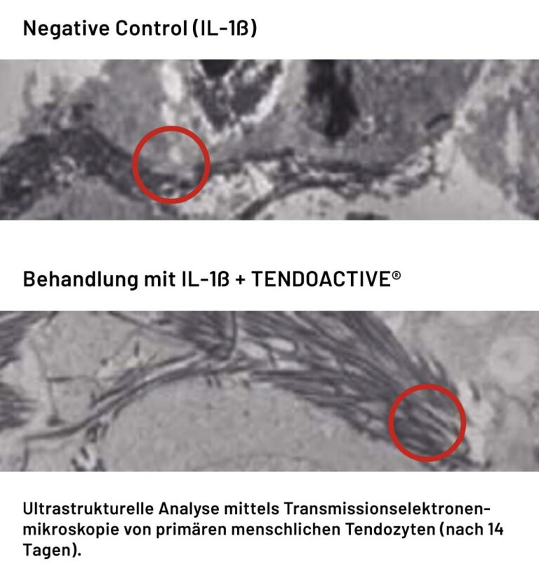 Bild was macht Tendoactive