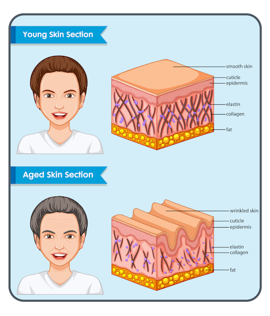 Hautalterung - Vergleich jung & alt