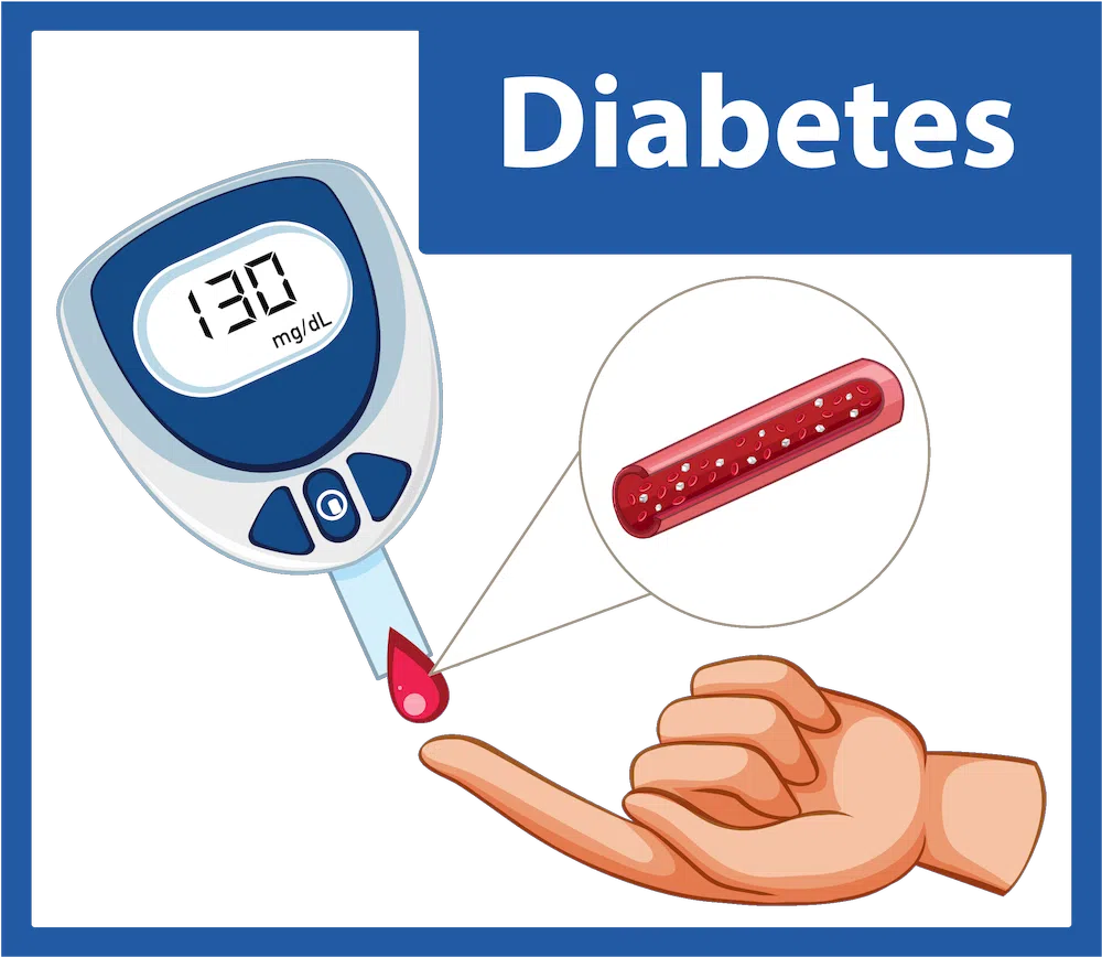 Schematische Darstellung von Diabetes - Blutzucker messen