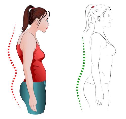 Haltungsschäden bei Osteoporose