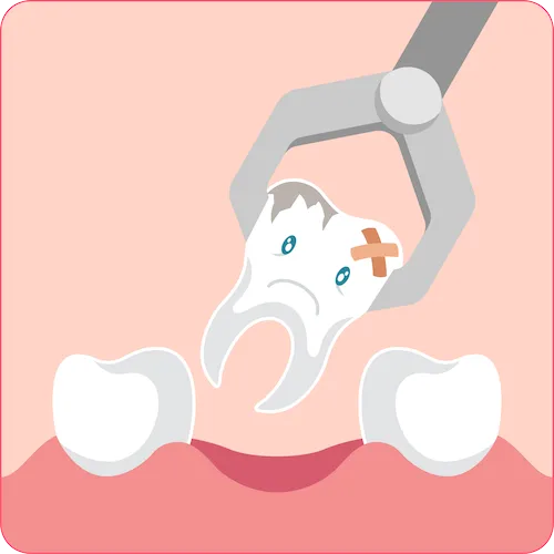Zahnausfall bei Osteoporose